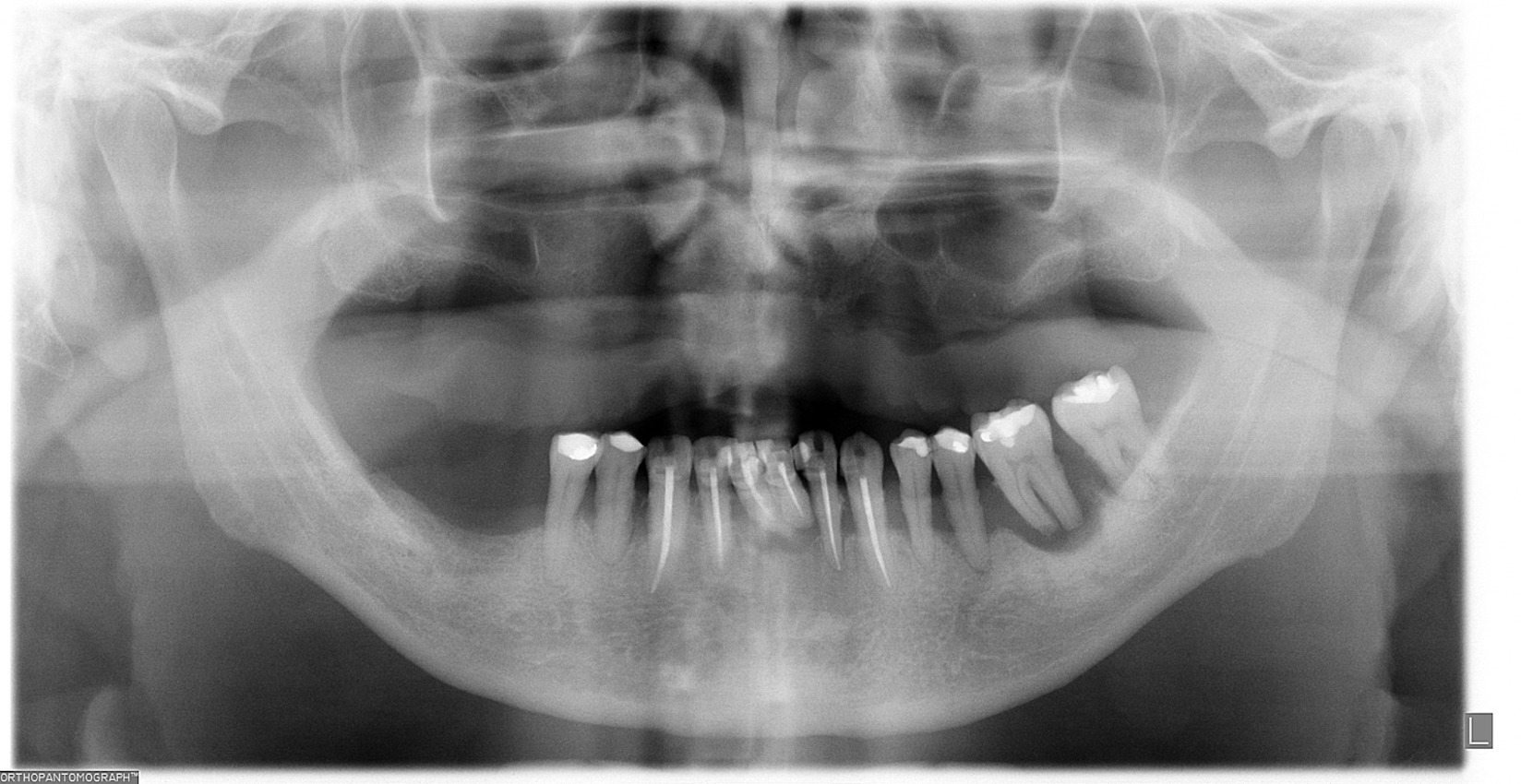 radiografia